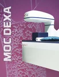 MOC DEXA | Prevenire l'osteoporosi